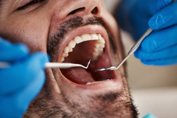 Dental X-Rays and Imaging in Wheeling, WV